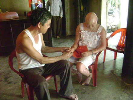 Cô gái quanh năm lột da như rắn - 1