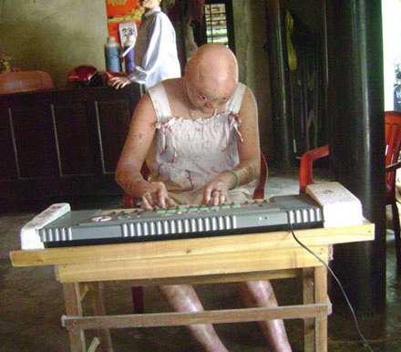 Cô gái quanh năm lột da như rắn - 2