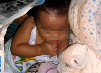 Bé 2 tuổi mất ngón tay vì máy xay thịt - 1 Bé 2 tuổi mất ngón tay vì máy xay thịt - 1