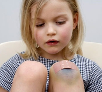 Những chứng bệnh cần vitamin C - 1