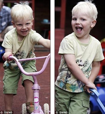 Bé 13 tháng tuổi bị bỏng cả mặt vì nước trà nóng - 2