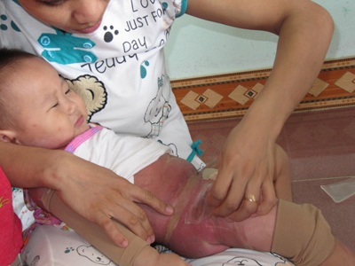 Tấm lòng thầy trò ở một cơ sở Tin học đến với cháu bé bị bỏng  - 2