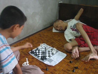 Bại não, teo cơ vẫn chơi cờ vua cực “đỉnh” - 1