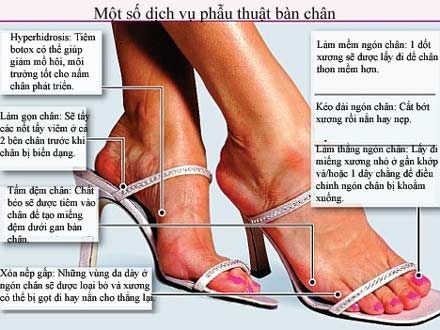 Nguy hiểm như mốt gọt chân đi vừa giày “xinh” - 2