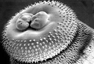 Biểu hiện khi nhiễm bệnh giun đầu gai - 1 Biểu hiện khi nhiễm bệnh giun đầu gai - 1