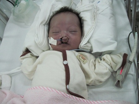 Bé trai dị dạng khát khao bàn tay mẹ - 1