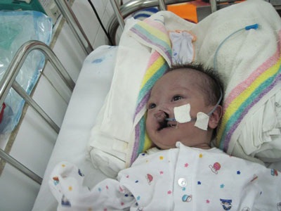 Giảm nhiễm trùng máu nhưng Nhân Ái đang bị viêm ruột - 2 Giảm nhiễm trùng máu nhưng Nhân Ái đang bị viêm ruột - 2