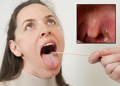 Những chứng thường gặp của cơ thể - 6