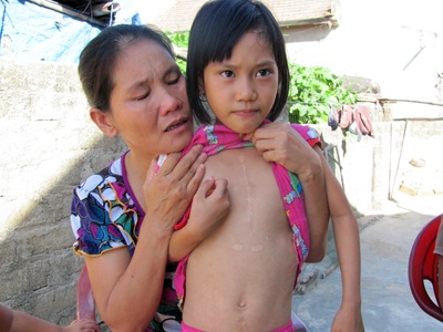 Ba đứa trẻ thơ và người mẹ khốn khổ - 2