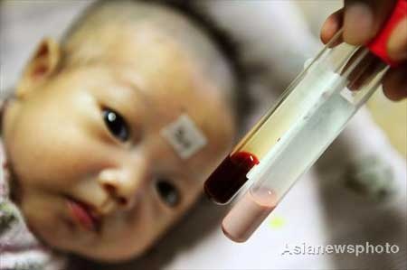 Em bé mang dòng máu màu hồng kỳ lạ - 2