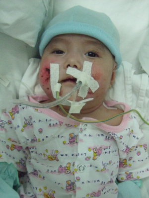 20h57 ngày 10/8: Bé Nhân Ái đã bớt phù - 1