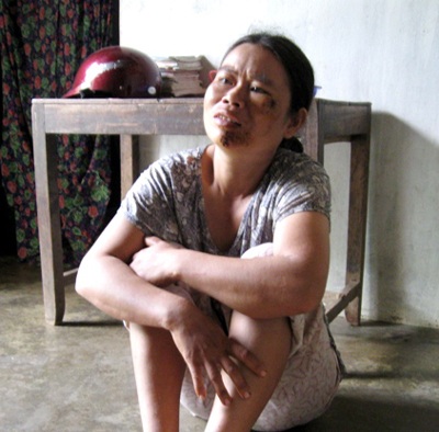 Người cựu chiến binh nghèo và 3 đứa con điên  - 2