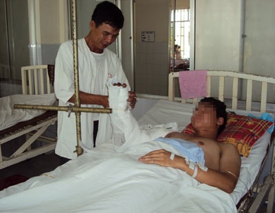 Nối thành công cánh tay bị đứt lìa - 1 Nối thành công cánh tay bị đứt lìa - 1