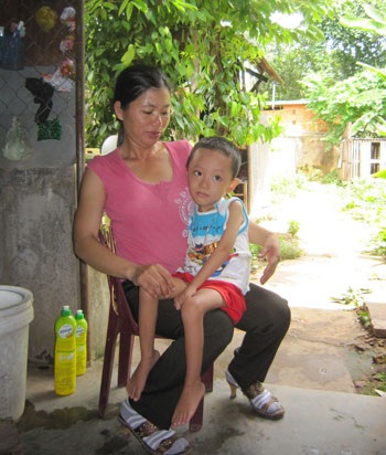 Lời kêu cứu của cậu bé 5 tuổi mắc bệnh hiếm gặp - 1 Lời kêu cứu của cậu bé 5 tuổi mắc bệnh hiếm gặp - 1