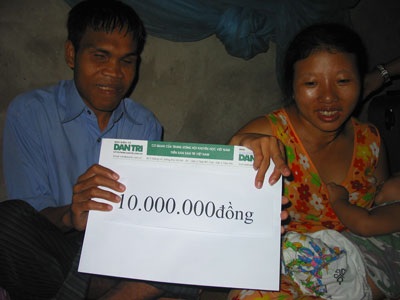 Cùng thắp sáng hi vọng cho bé 7 tháng tuổi bị u máu - 3 Cùng thắp sáng hi vọng cho bé 7 tháng tuổi bị u máu - 3