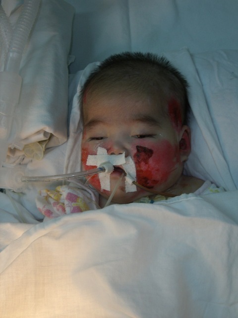 Ngày 06/09: Sức khỏe của bé Nhân Ái đang dần xấu đi - 1