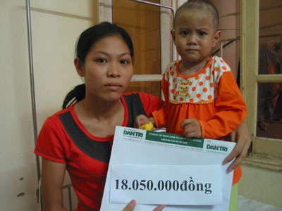 Bé 3 tuổi bỏng toàn thân sắp được xuất viện - 2 Bé 3 tuổi bỏng toàn thân sắp được xuất viện - 2