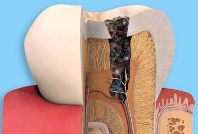 Răng ê buốt do đâu? - 6