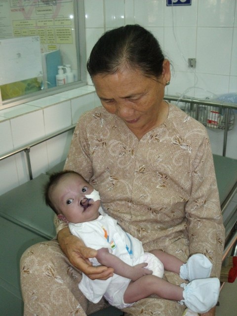 Hai ngày nữa "em trai" bé Nhân Ái sẽ phẫu thuật tim - 1