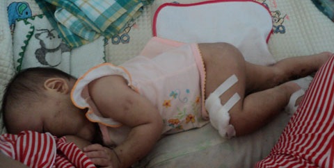 Cháu bé 9 tháng tuổi bị hành hạ dã man - 1