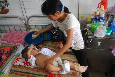 Bé 10 tháng tuổi thoi thóp chống chọi căn bệnh viêm màng não mủ - 1 Bé 10 tháng tuổi thoi thóp chống chọi căn bệnh viêm màng não mủ - 1
