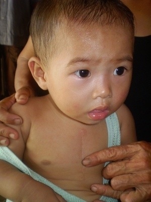 Xót xa phận bé sống trong cảnh “thập tử nhất sinh” - 1