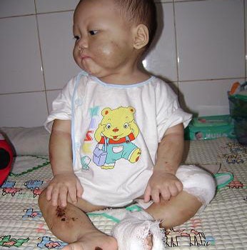 Ám ảnh khi đọc bài viết về bé Như Ý - 1