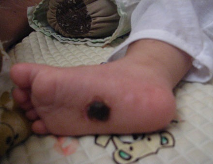 Hình ảnh mới nhất của cháu bé bị cha dượng hành hạ dã man - 2