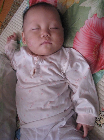 Hình ảnh mới nhất của cháu bé bị cha dượng hành hạ dã man - 1