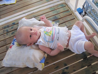 Bé gái thoi thóp từng ngày nương nhờ cửa Phật - 1 Bé gái thoi thóp từng ngày nương nhờ cửa Phật - 1