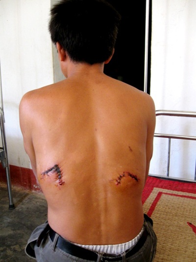 Thú lạ tấn công người đi rừng là đười ươi - 1