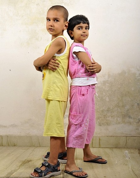 Cậu bé 2 tuổi rưỡi cao bằng trẻ 10 tuổi - 2