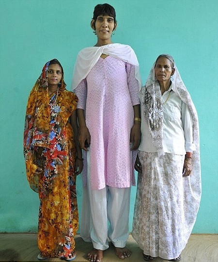 Cậu bé 2 tuổi rưỡi cao bằng trẻ 10 tuổi - 3