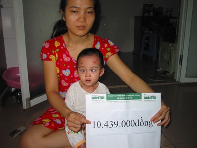 Mong manh tìm đường chữa bệnh cho bé bị “lột da ếch” - 2 Mong manh tìm đường chữa bệnh cho bé bị “lột da ếch” - 2
