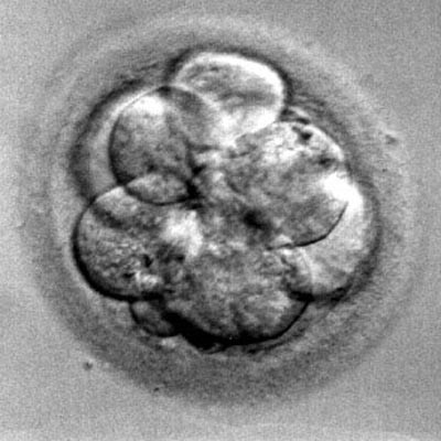 Tăng tỉ lệ thụ thai bằng IVF: Quay phim sự phát triển của phôi thai - 1 Tăng tỉ lệ thụ thai bằng IVF: Quay phim sự phát triển của phôi thai - 1