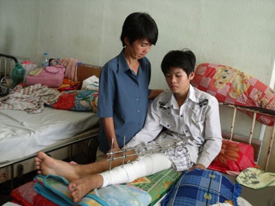 Số phận bất hạnh của đứa con không cha “múa lửa” nuôi mẹ - 1 Số phận bất hạnh của đứa con không cha “múa lửa” nuôi mẹ - 1