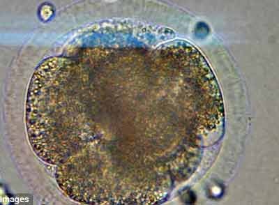 Chào đời từ phôi mầm trữ lạnh tới 20 năm - 1