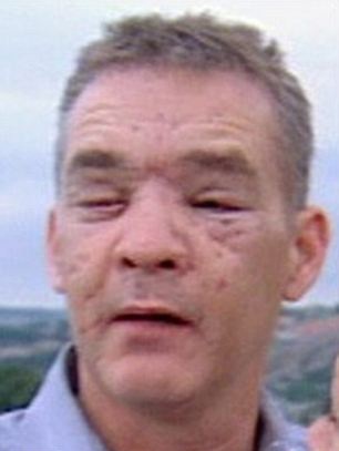 Sống sót kỳ diệu sau khi bị bắn 200 mảnh đạn vào đầu - 2 Sống sót kỳ diệu sau khi bị bắn 200 mảnh đạn vào đầu - 2