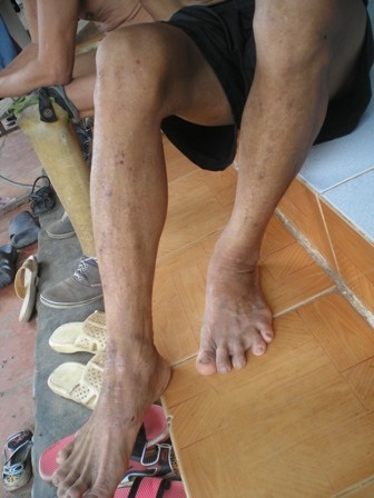 Nguy cơ dịch bệnh từ dòng suối bị “đầu độc” - 2