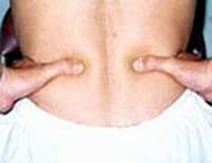 Cách xoa bóp chữa đau thắt lưng - 1 Cách xoa bóp chữa đau thắt lưng - 1