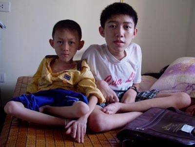 Nỗi ám ảnh của gia đình bị bệnh trùng gen - 2