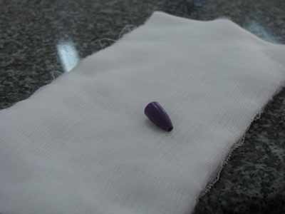 Vỏ đầu bút bi nằm trong phổi hơn 20 ngày - 1 Vỏ đầu bút bi nằm trong phổi hơn 20 ngày - 1