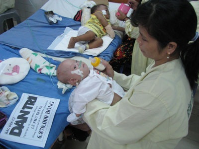 Sức khỏe bé bị bỏ rơi Lê Như Quỳnh đã khá hơn - 1