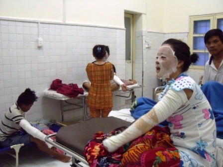 Cứu sống mẹ con thai phụ bỏng lửa nặng - 1