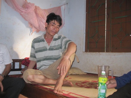 Đã tìm ra bệnh lạ của 23 người ăn thịt “trăn tinh” - 1 Đã tìm ra bệnh lạ của 23 người ăn thịt “trăn tinh” - 1