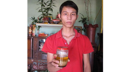 Hoang mang chuyện 23 người mắc bệnh lạ vì ăn thịt “trăn tinh” - 2 Hoang mang chuyện 23 người mắc bệnh lạ vì ăn thịt “trăn tinh” - 2