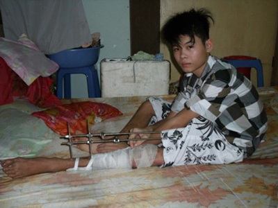 Hơn 8 triệu đồng đến với cậu bé “múa lửa” nuôi mẹ - 1 Hơn 8 triệu đồng đến với cậu bé “múa lửa” nuôi mẹ - 1