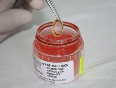 Hơn 30.000 người đăng ký hiến tặng giác mạc - 1