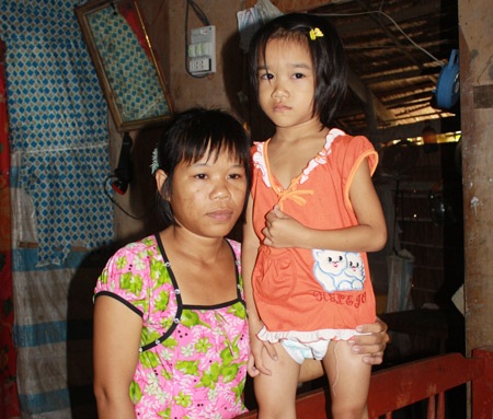 Xót xa bé gái không hậu môn, không bộ phận sinh dục - 1 Xót xa bé gái không hậu môn, không bộ phận sinh dục - 1