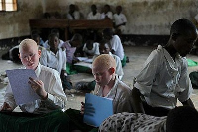 Người bạch tạng đầu tiên đắc cử nghị sĩ Tanzania - 1 Người bạch tạng đầu tiên đắc cử nghị sĩ Tanzania - 1